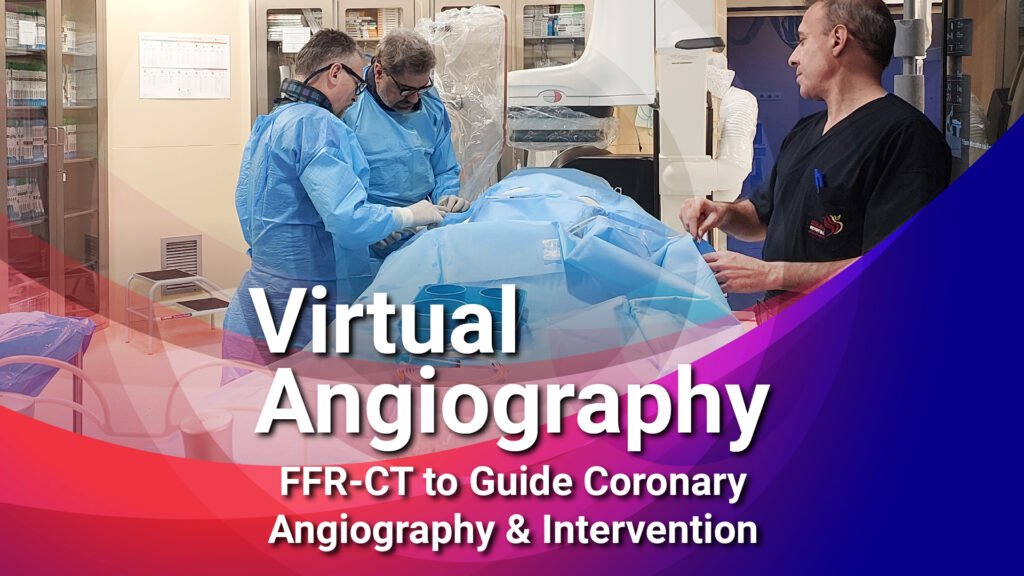 آنژیوگرافی مجازی یا Virtual Angiography